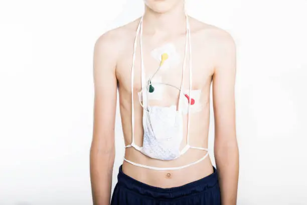 Teenager on white background with Holter on chest.  Heart electrocardiogram or monitoring using Holter for young patient. Healthcare concept