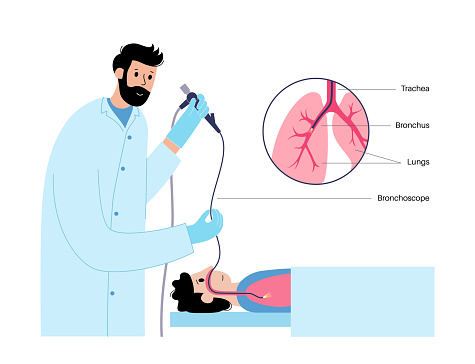 Bronchoscopy Stack Bronchoscopy Procedure Concept Stock Illustration - Download Image Now ...
