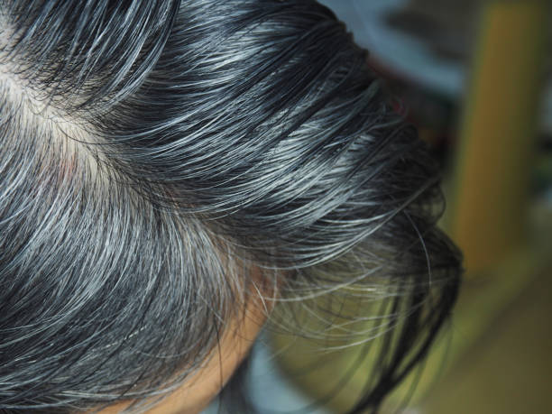 istock gray and white hair 1500483582