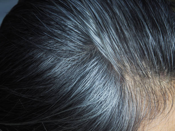 istock gray and white hair 1500483668