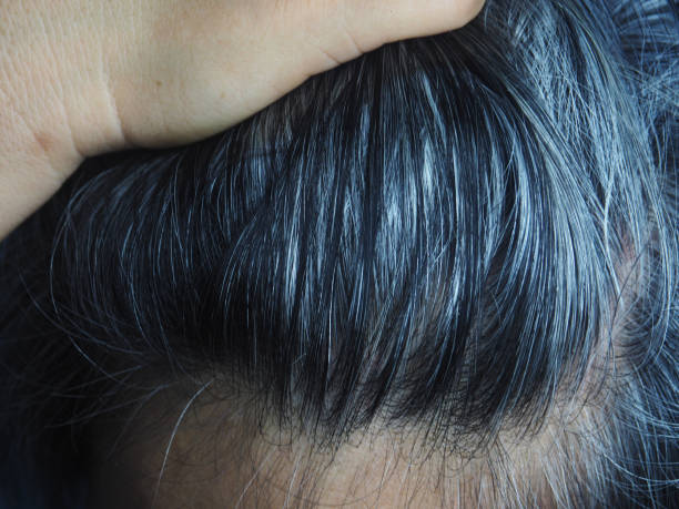 istock gray and white hair 1500483692