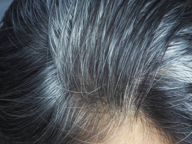 istock gray and white hair 1500483694