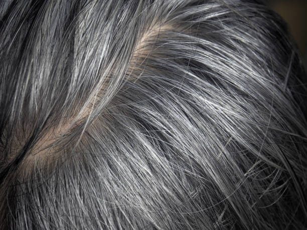 istock gray and white hair 1500483717