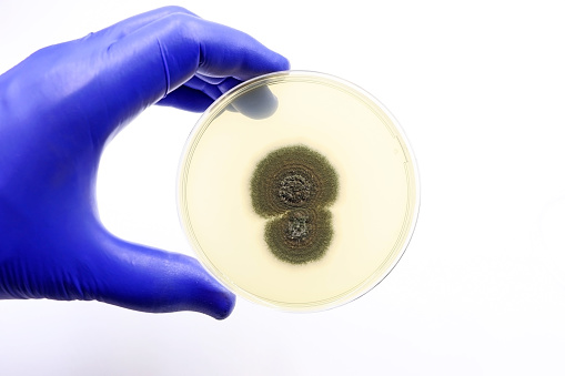 Fungus isolated in the Microbiology laboratory. Fungal infections by pathogenic fungi
