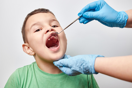 Examination Of The Oral Cavity Of A Boy With Missing Milk Teeth Loss Of