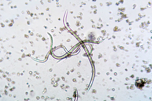 The nematode Steinernema feltiae under the microscope, the species used as a biopesticide to infect fungus gnats in agriculture and gardening.