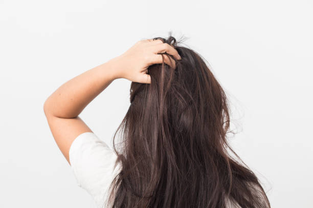 istock Women itching scalp itchy his hair 1501321453