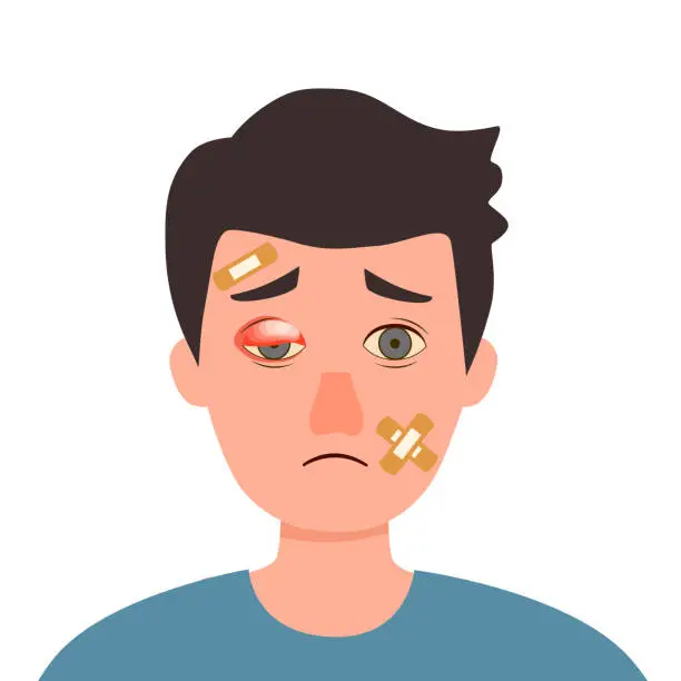 Vector illustration of Man with swollen eye and injured face in flat design on white background.