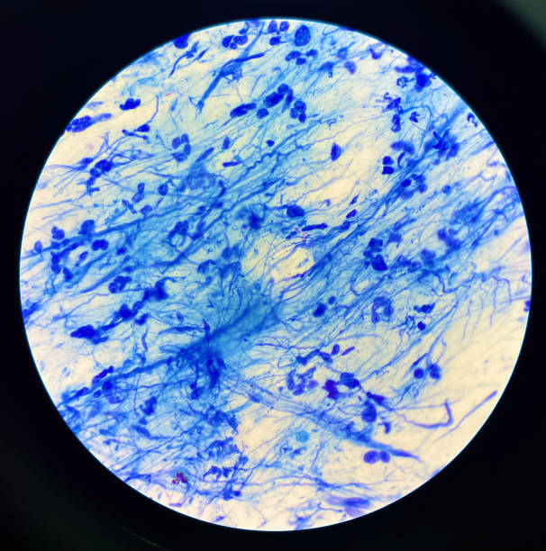 istock Red cell on center Mycobacterium Tuberculosis bacteria. 1501337470