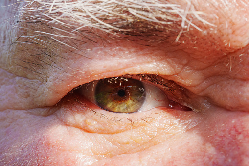 close-up. The eye of a old man with shaggy gray eyebrows. macro photography. The concept of aging of the skin on the face and eye diseases in the elderly.
