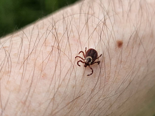 istock Closeup of Deer Tick on Arm 1502536979