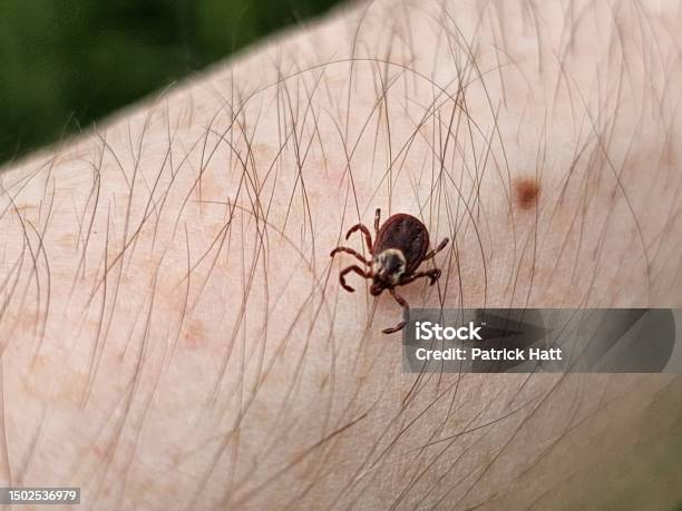 Closeup Of Deer Tick On Arm Stock Photo - Download Image Now - Lyme Disease, Animal, Animal Wildlife