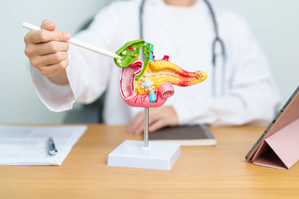 Doctor with human Pancreatitis anatomy model with Pancreas, Gallbladder, Bile Duct, Duodenum, Small intestine and tablet. Pancreatic cancer, acute pancreatitis and Digestive system Doctor with human Pancreatitis anatomy model with Pancreas, Gallbladder, Bile Duct, Duodenum, Small intestine and tablet. Pancreatic cancer, acute pancreatitis and Digestive system gall bladder stock pictures, royalty-free photos & images