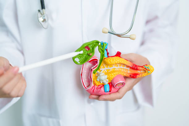 doctor with human pancreatitis anatomy model with pancreas, gallbladder, bile duct, duodenum, small intestine. pancreatic cancer, acute and chronic pancreatitis,  digestive system and health concept - gland lobule imagens e fotografias de stock