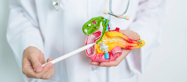 doctor with human pancreatitis anatomy model with pancreas, gallbladder, bile duct, duodenum, small intestine. pancreatic cancer, acute and chronic pancreatitis,  digestive system and health concept - gland lobule imagens e fotografias de stock