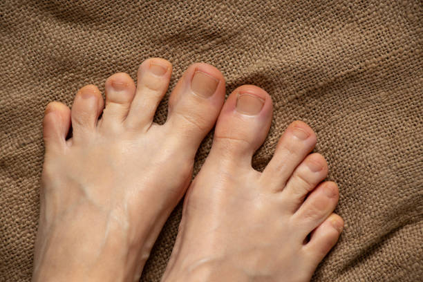 istock female bare feet on an old wooden floor 1502765294