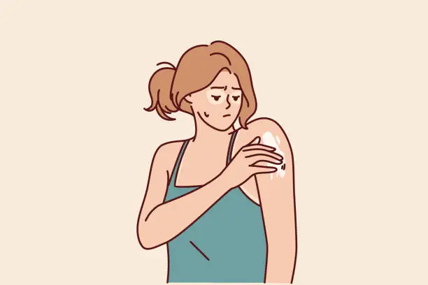 Vector illustration of Woman with sunburn applies healing cream on shoulder to repair skin after exposure to ultraviolet