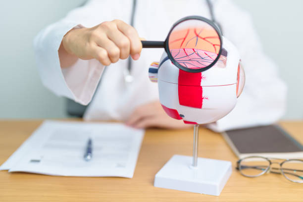 istock Doctor with human Eye anatomy model with magnifying glass. Eye disease, Refractive Errors, Age Related Macular Degeneration, Cataract, Diabetic Retinopathy, Glaucoma, Amblyopia, Strabismus and Health 1502822021