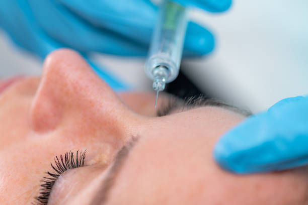 istock Treating Forehead Lines with Hyaluronic Acid Fillers 1502867089