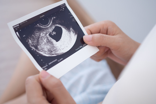 pregnant woman is looking at an ultrasound photo of fetus. Mother gently touches the baby on stomach. Happy, family, growth, pregnancy, enjoyment , prepare newborn, take care, healthcare, tummy.