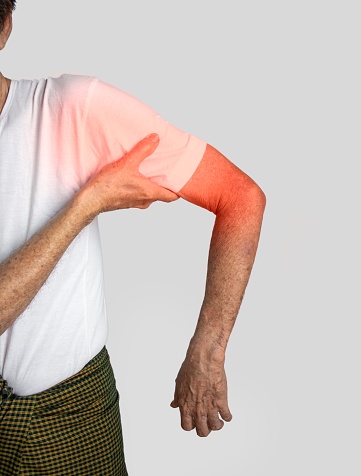 Pain in the upper arm and shoulder joint of Southeast Asian old man. Concept of frozen shoulder.
