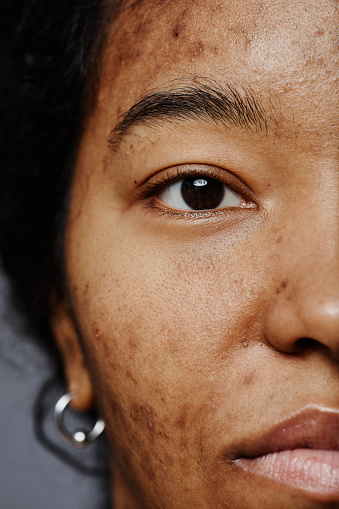 Half shot closeup of black young woman with no makeup looking at camera