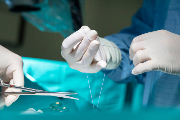 médecin faisant des points de suture chirurgicaux - surgical needle photos photos et images de collection