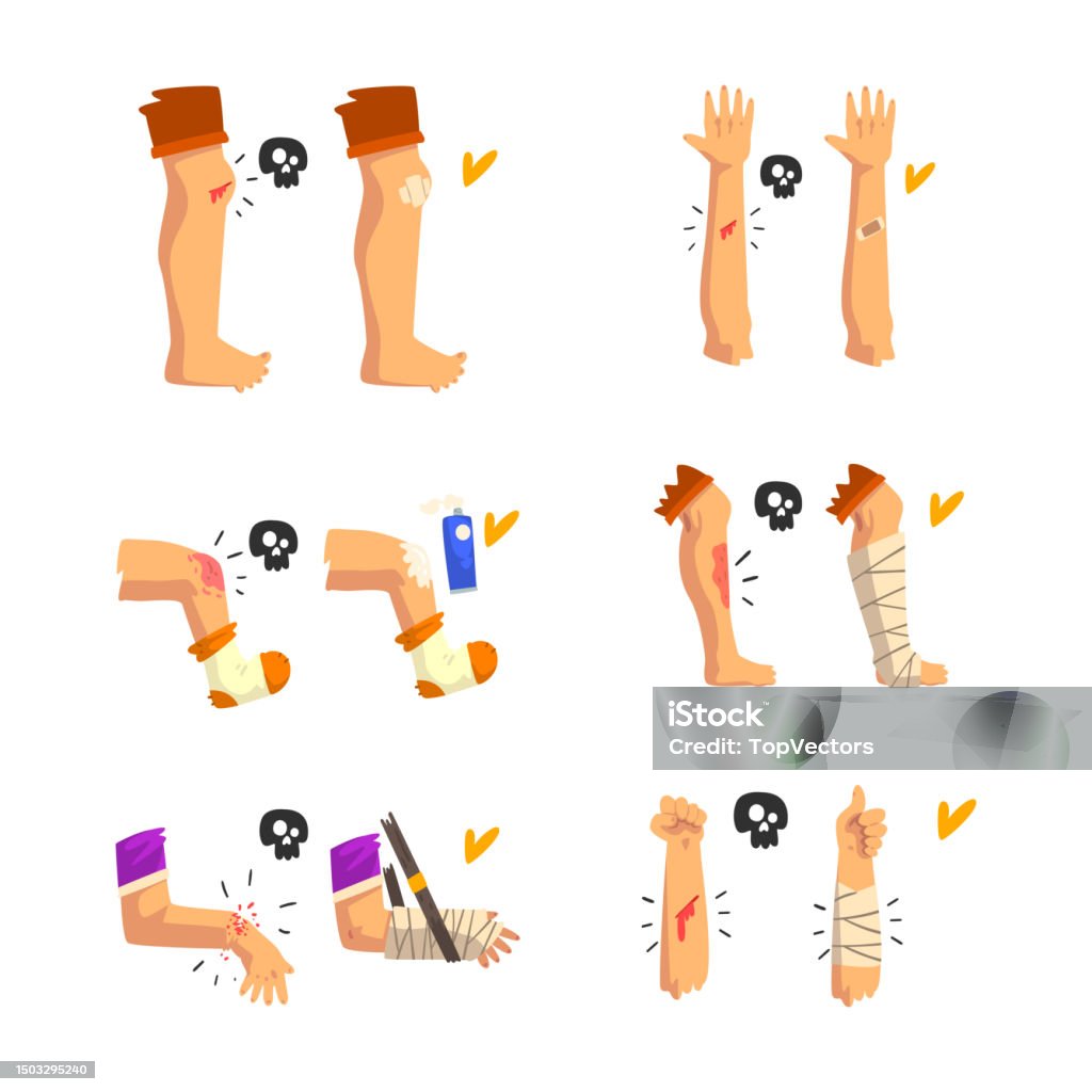 Wounded Knee Vector First Aid For Wounded Leg And Arm Vector Set Stock Illustration ...