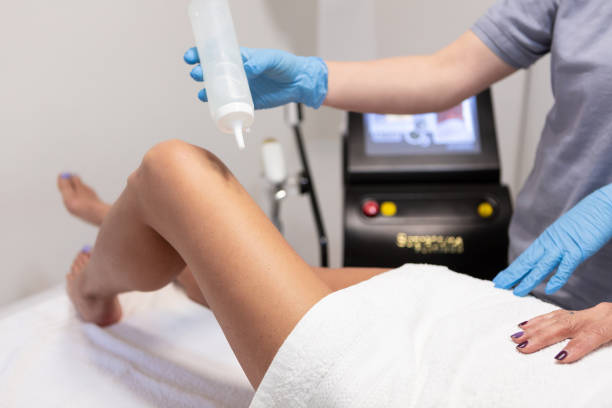 istock Leg laser hair removal process 1503669450
