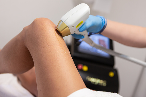 Laser hair removal process - Buenos Aires - Argentina