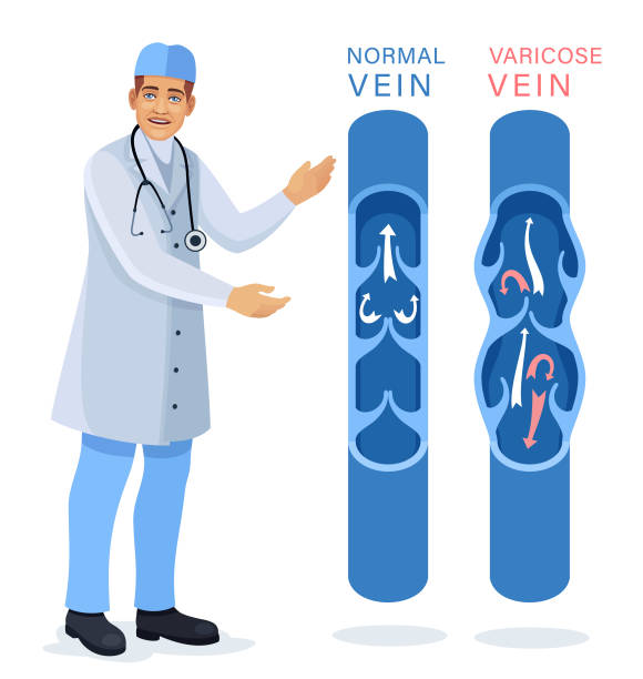 Doctor examining and diagnosis Blood Vessels and Veins Diseases. Varicose Veins Treatment. vector art illustration