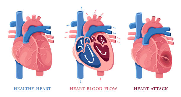 zdrowe serce. przepływ krwi w sercu. zawał serca. anatomia ludzkiego serca. - human artery cholesterol atherosclerosis human heart stock illustrations