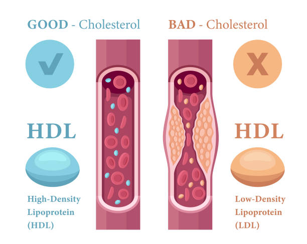 Types of cholesterol in the blood concept. High-Density Lipoprotein (HDL) and Low-Density Lipoprotein (LDL). vector art illustration