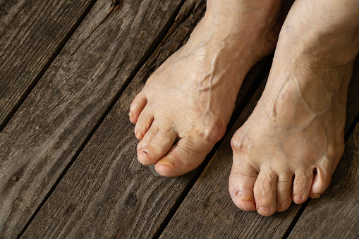 old grandmother's feet on the floor in her room close-up