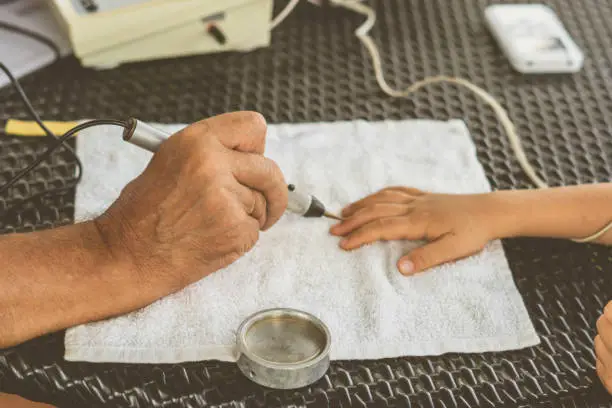 Photo of Vegetative resonance testing method of electroacupuncture diagnostics of human diseases, hand electrodes metal probe