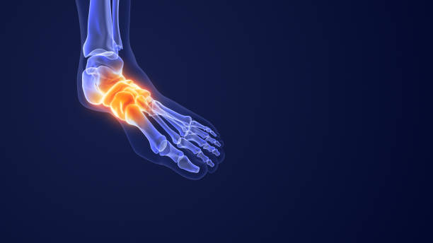 istock Pain from aching feet and fallen arches 1508237514