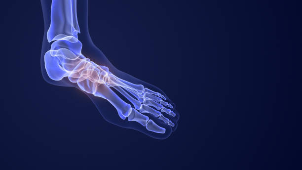 istock Pain from aching feet and fallen arches 1508237515