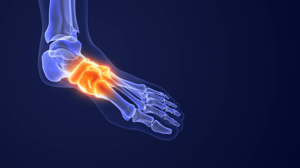 istock Pain from aching feet and fallen arches 1508237516