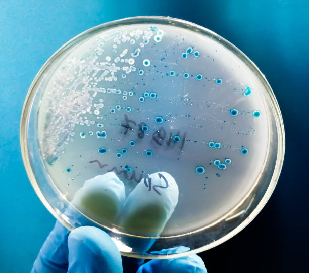 istock streptococcus pneumoniae in petri dish, sputum culture. 1509673470