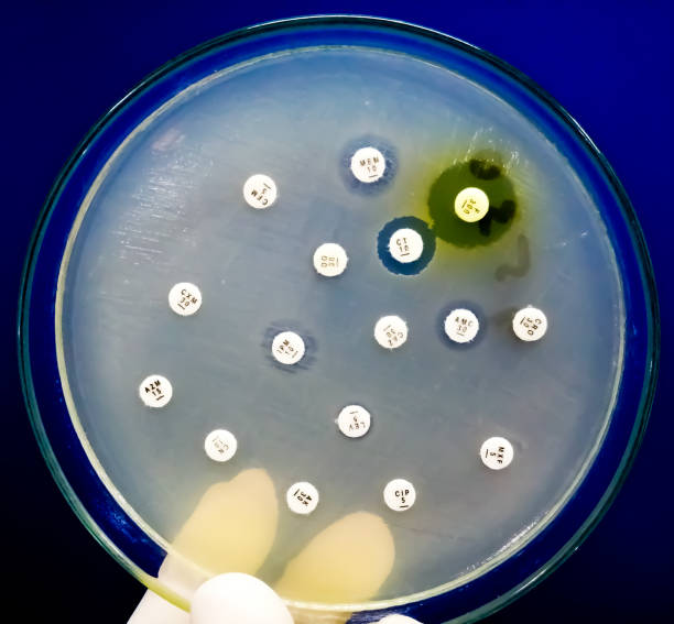 istock Antimicrobial susceptibility testing in petri dish. Antibiotic resistance of bacteria 1509673988