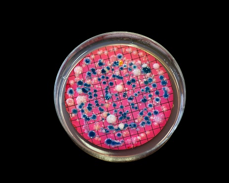 A petri dish with Escherichia coli colonies isloated on a black backdrop.
