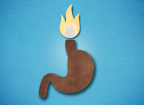 Pyrosit Form Heartburn Or Pyrosis Gerd Conceptual Illustration Stock Illustration ...