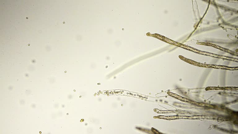 fungus spores micrograph