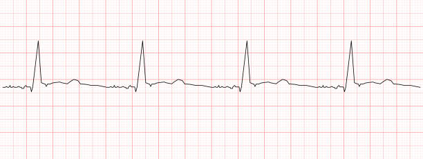 istock Black heart beat diagram on red graph paper. Electrocardiogram chart example. Cardiac rhythm line. Cardio test sign. Cardiology hospital symbol 1512395106