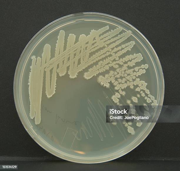 Colonie Batteriche Su Una Piastra Di Petri - Fotografie stock e altre immagini di Bacillus subtilis - Bacillus subtilis, Batterio, Biologia