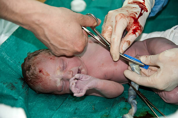 cut of an umbilical chord stock photo