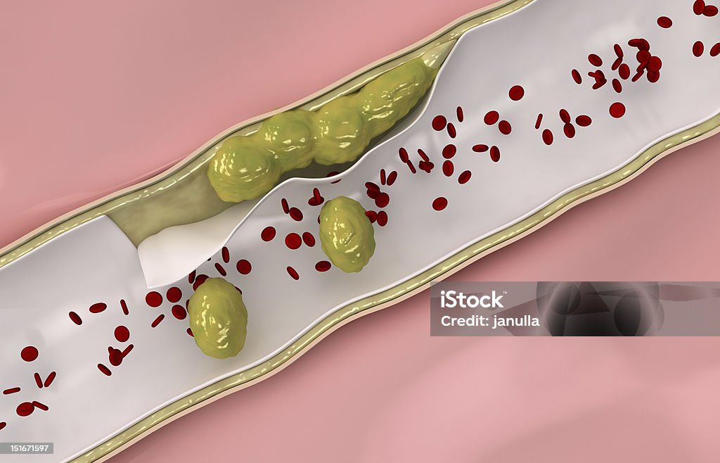 コレステロール流れる内静脈 - 血液のロイヤリティフリーストックフォト