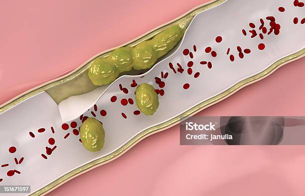 Colesterol Fluir No Interior Da Veia - Fotografias de stock e mais imagens de Sangue - Sangue, Anatomia, Artéria Coronária