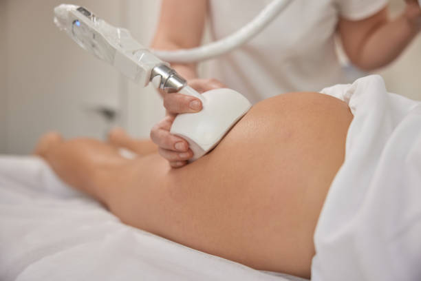 istock figure correction, FDA-approved, Anti-cellulite 1517412113