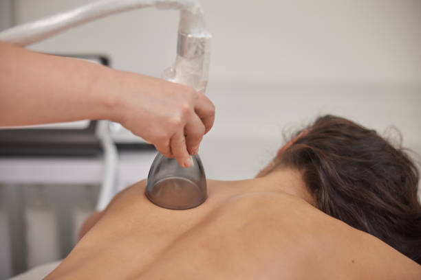 istock vacuum massage, receiving massage, Anti-cellulite, 1517412640